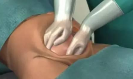 顺产过程视频,从宫缩到分娩的震撼瞬间